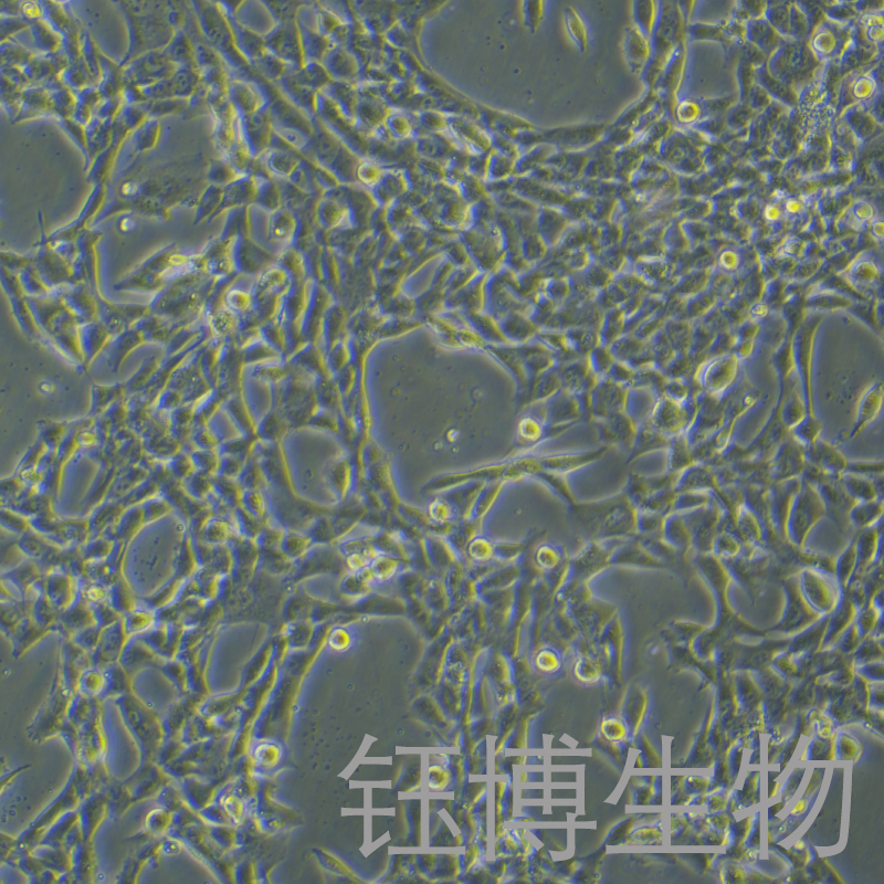 HCC1395（人乳腺癌细胞 （三阴性））YB-71979HC