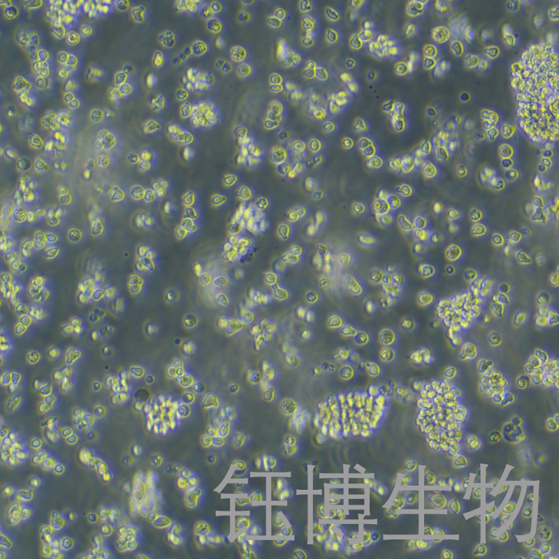 OCI-Ly7（人弥漫大B淋巴瘤细胞）YB-71982HC