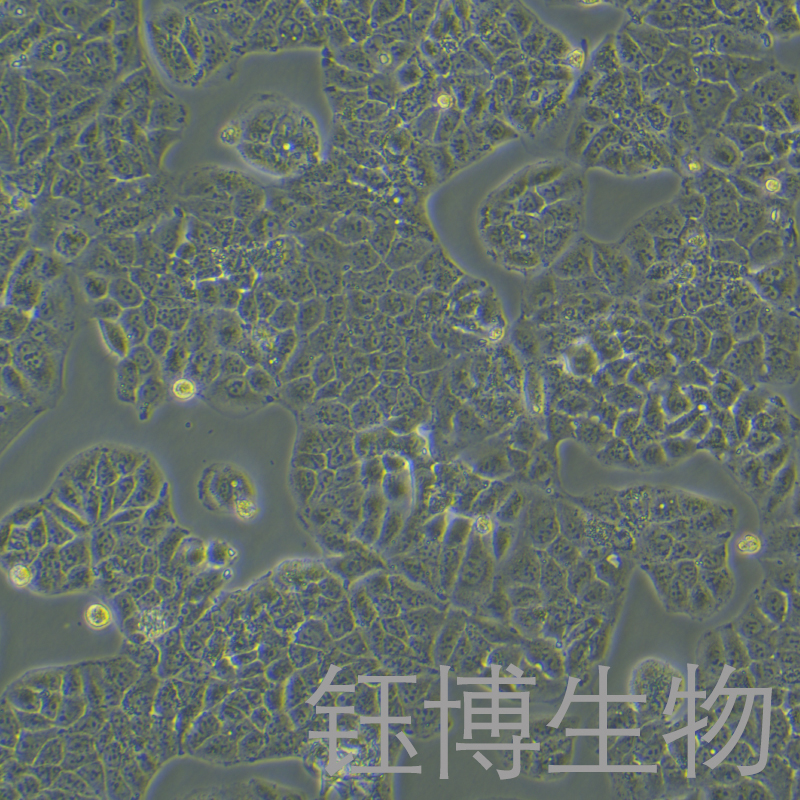 Huh-1（人肝癌细胞）YB-71981HC