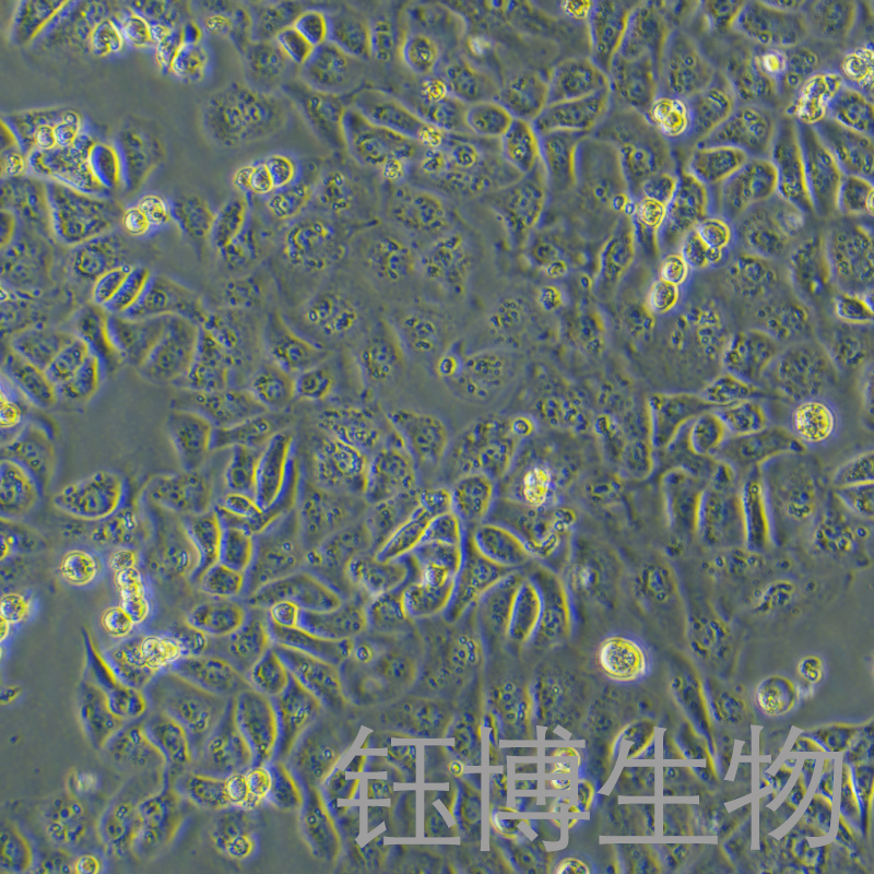 IGROV-1（人卵巢癌细胞/卵巢子宫内膜样腺癌）YB-71987HC