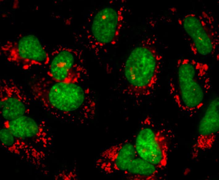 FITC-卵清蛋白，FITC-OVA