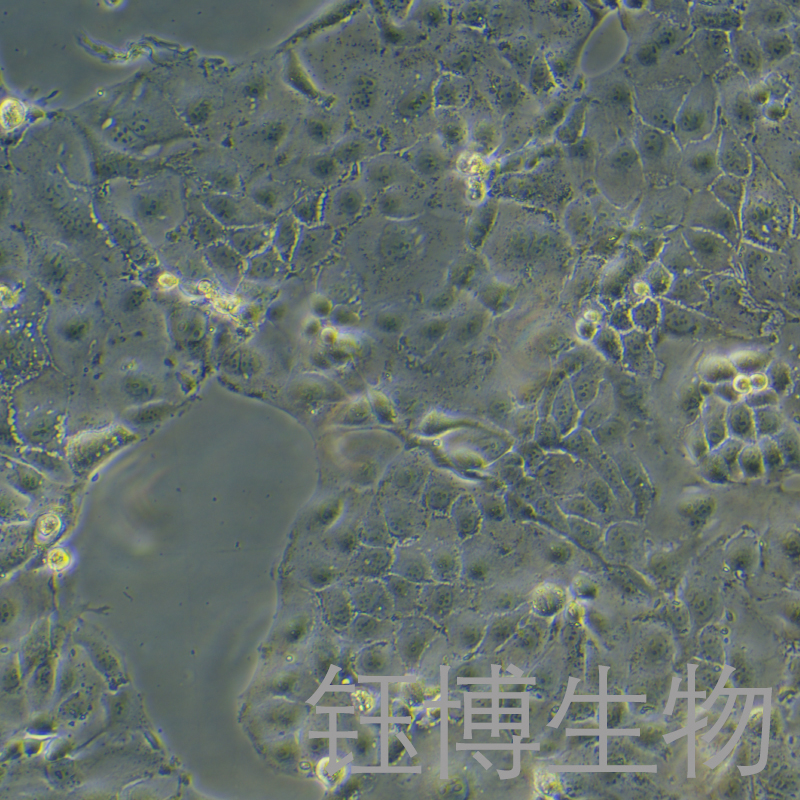 OAW28（人卵巢上皮性肿瘤细胞）YB-71990HC