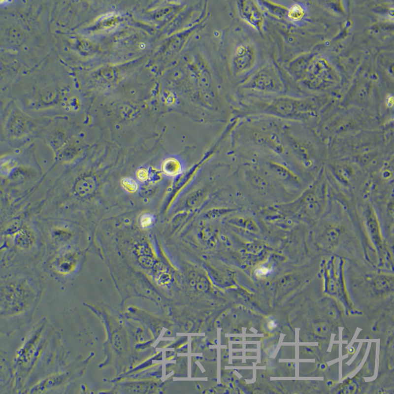 HUH-28（人胆管癌细胞）YB-72005HC