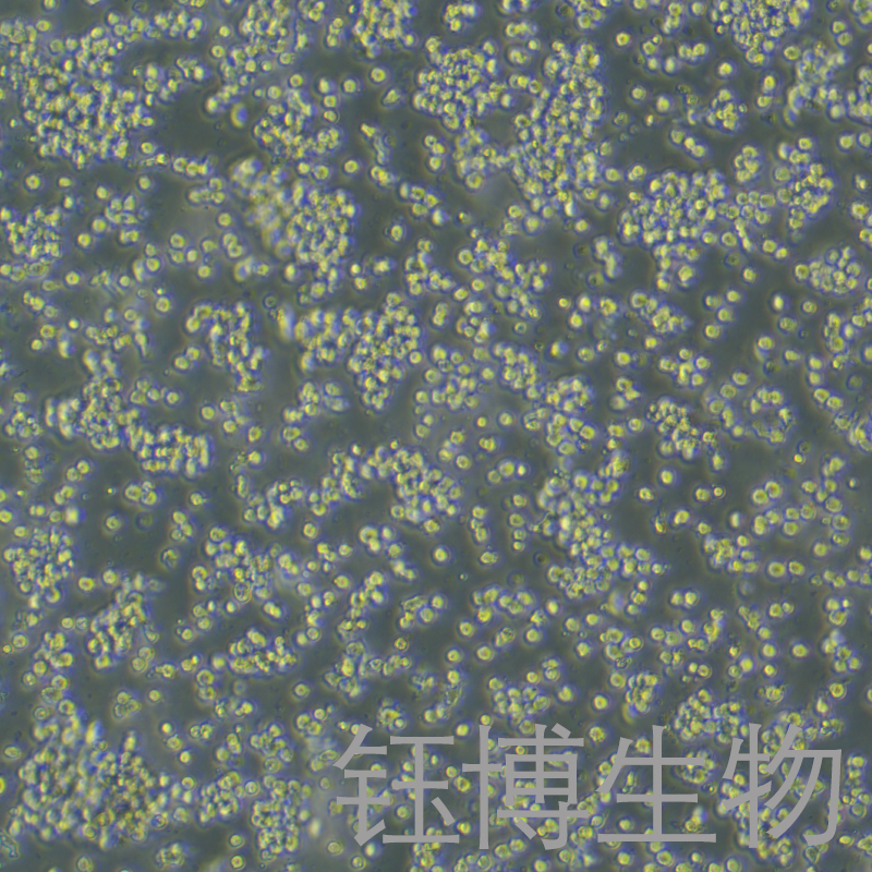 EOL-1（人嗜酸性粒细胞白血病细胞株）YB-72007HC