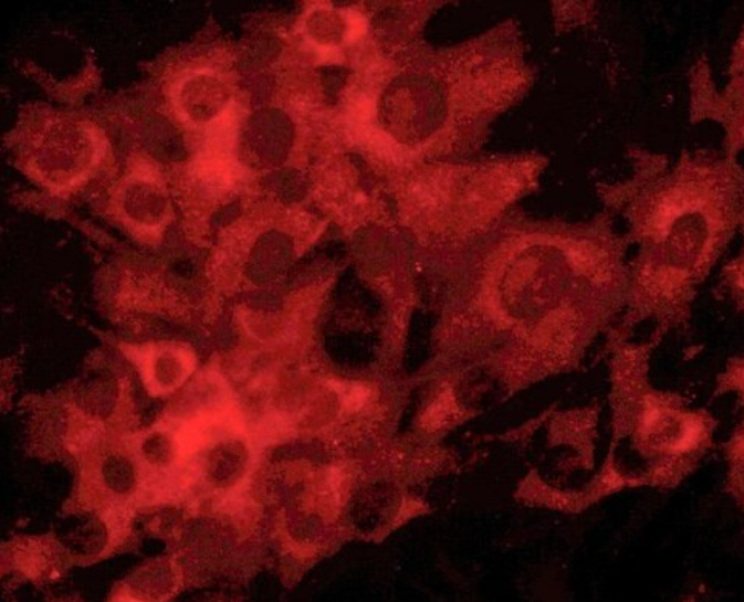 大鼠小梁网细胞