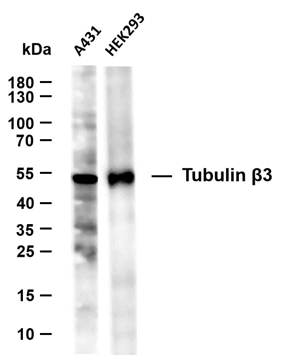 Tubulin beta-3 (12Z6) Rabbit Monoclonal Antibody | 内参抗体 | EnkiLife恩玑生命