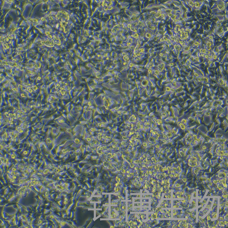 GP2d（人结肠癌细胞）YB-72013HC