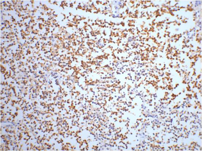 NSE (4C7) Mouse Monoclonal Antibody | 鼠单抗 | EnkiLife恩玑生命