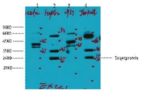 ERCC1(1B10)Mouse Monoclonal Antibody | 鼠单抗 | EnkiLife恩玑生命