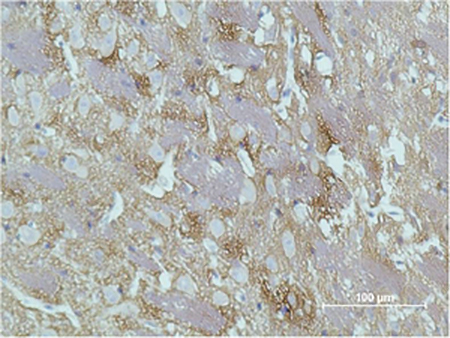 GAP-43(Mix)Mouse Monoclonal Antibody | 鼠单抗 | EnkiLife恩玑生命