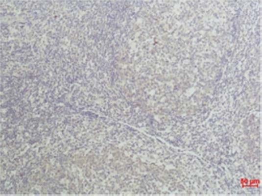 TNF α(Q34)Mouse Monoclonal Antibody | 鼠单抗 | EnkiLife恩玑生命