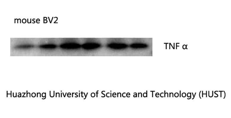 TNF α(Q34)Mouse Monoclonal Antibody | 鼠单抗 | EnkiLife恩玑生命