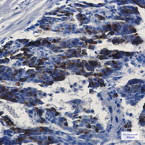 MMP14 Rabbit Monoclonal Antibody | 兔单抗 | EnkiLife恩玑生命