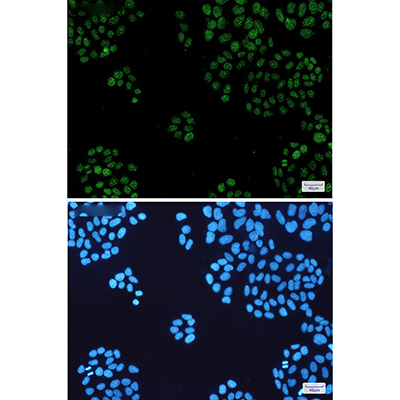 HP1 alpha Rabbit Monoclonal Antibody | 兔单抗 | EnkiLife恩玑生命