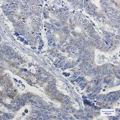 NDUFB4 Rabbit Monoclonal Antibody | 兔单抗 | EnkiLife恩玑生命