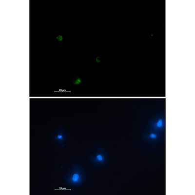 NUDT19 Rabbit Monoclonal Antibody | 兔单抗 | EnkiLife恩玑生命