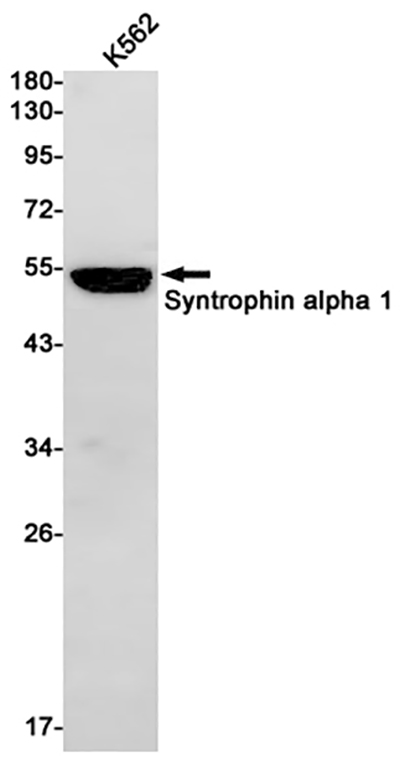 Syntrophin alpha 1 Rabbit Monoclonal Antibody | 兔单抗 | EnkiLife恩玑生命