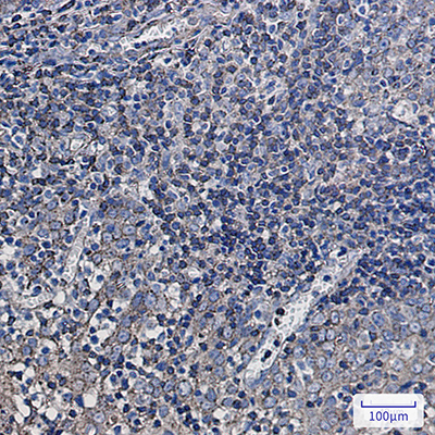 Synaptophysin Like Protein 1 Rabbit Monoclonal Antibody | 兔单抗 | EnkiLife恩玑生命