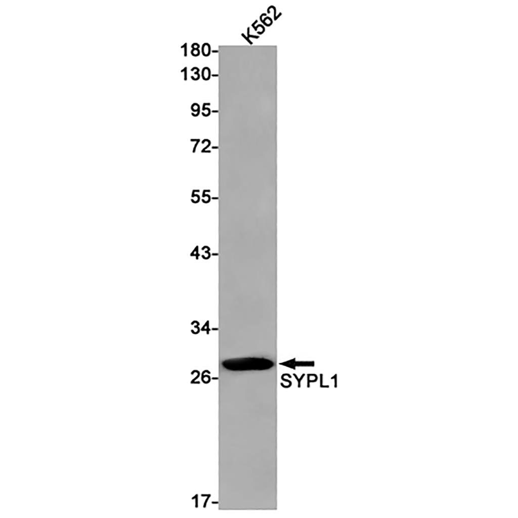 Synaptophysin Like Protein 1 Rabbit Monoclonal Antibody | 兔单抗 | EnkiLife恩玑生命