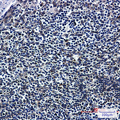 RanGAP1 Rabbit Monoclonal Antibody | 兔单抗 | EnkiLife恩玑生命