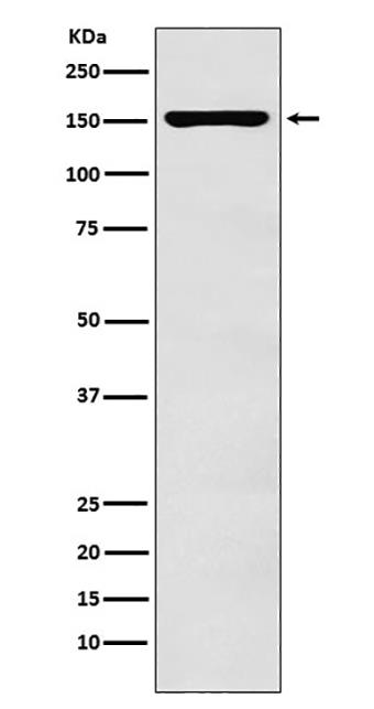 ADAR1 (16R16) Rabbit Monoclonal Antibody | 兔单抗 | EnkiLife恩玑生命
