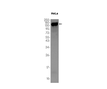 ADAR1 (16R16) Rabbit Monoclonal Antibody | 兔单抗 | EnkiLife恩玑生命
