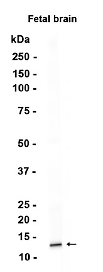 AP2S1 (16G15) Rabbit Monoclonal Antibody | 兔单抗 | EnkiLife恩玑生命