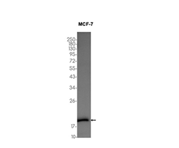 ARF6 (19O13) Rabbit Monoclonal Antibody | 兔单抗 | EnkiLife恩玑生命