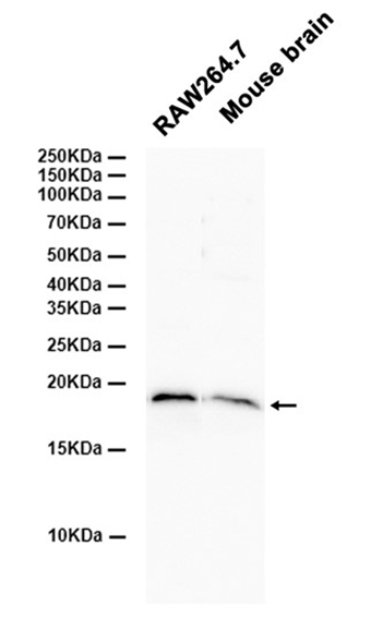 ARF6 (19O13) Rabbit Monoclonal Antibody | 兔单抗 | EnkiLife恩玑生命