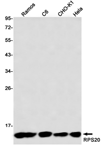 RPS20 (7B14) Rabbit Monoclonal Antibody | 兔单抗 | EnkiLife恩玑生命