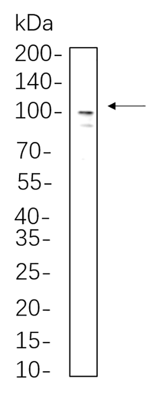 Sodium Potassium ATPase Rabbit Monoclonal antibody | 兔单抗 | EnkiLife恩玑生命