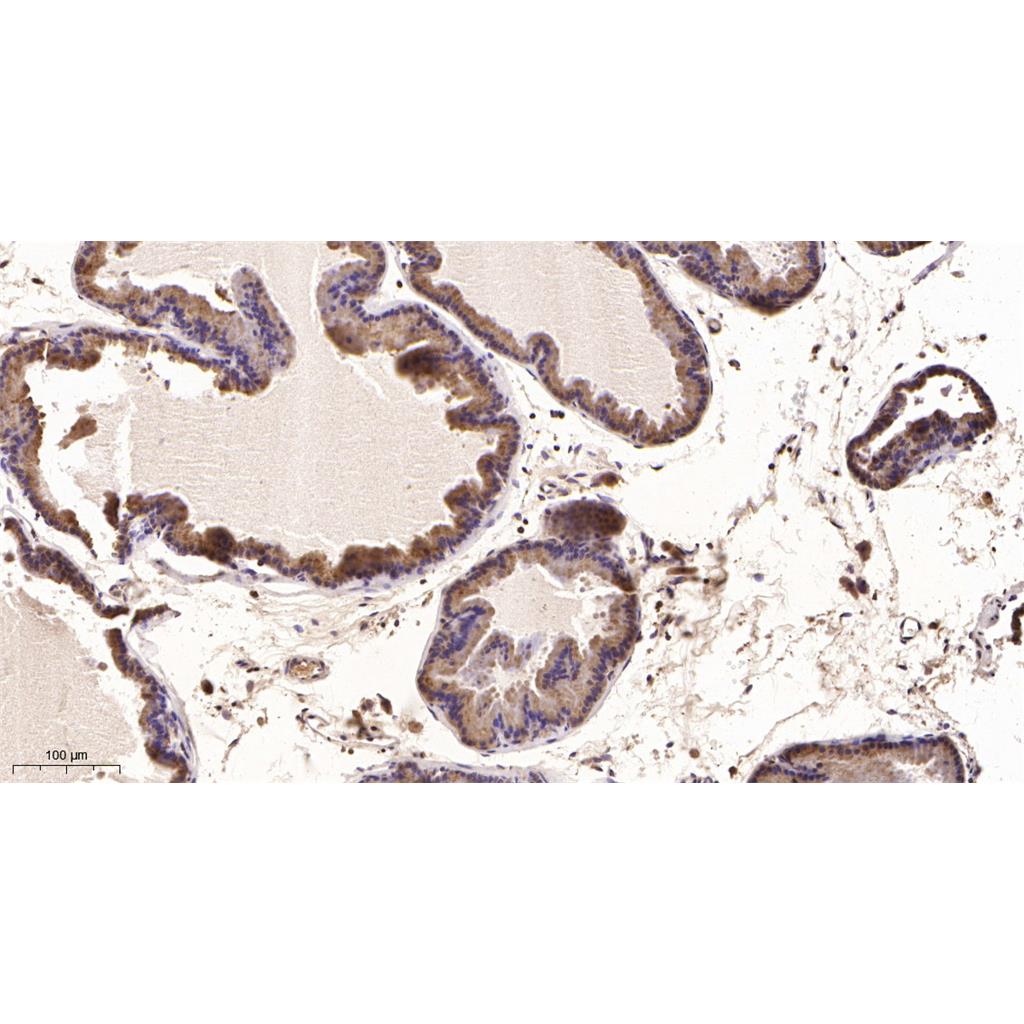 Prostein Rabbit Monoclonal antibody | 兔单抗 | EnkiLife恩玑生命