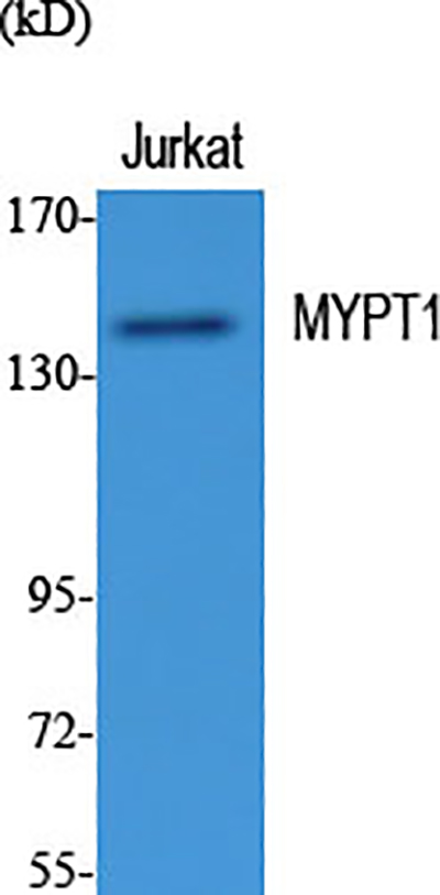 Myosin Phosphatase Rabbit Polyclonal Antibody | 兔多抗 | EnkiLife恩玑生命