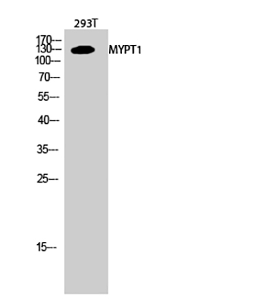 Myosin Phosphatase Rabbit Polyclonal Antibody | 兔多抗 | EnkiLife恩玑生命