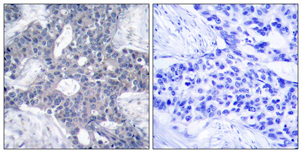 ZAP70 Rabbit Polyclonal Antibody | 兔多抗 | EnkiLife恩玑生命