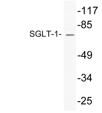 SGLT1 Rabbit Polyclonal Antibody | 兔多抗 | EnkiLife恩玑生命