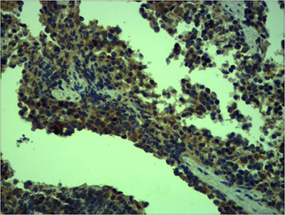 Toll-Like Receptor 4 Rabbit Polyclonal Antibody | 兔多抗 | EnkiLife恩玑生命