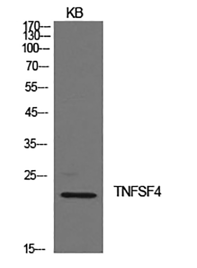OX40L Rabbit Polyclonal Antibody | 兔多抗 | EnkiLife恩玑生命