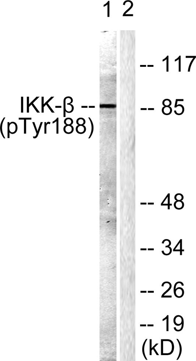 Phospho-IKK beta (Tyr188) Rabbit Polyclonal Antibody | 兔多抗 | EnkiLife恩玑生命