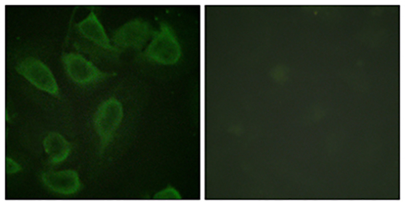 Phospho-CD31 (Tyr713) Rabbit Polyclonal Antibody | 兔多抗 | EnkiLife恩玑生命