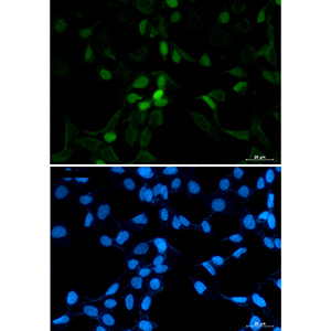 CDT1 Rabbit Polyclonal Antibody | 兔多抗 | EnkiLife恩玑生命