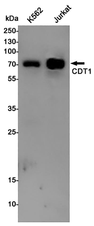 CDT1 Rabbit Polyclonal Antibody | 兔多抗 | EnkiLife恩玑生命