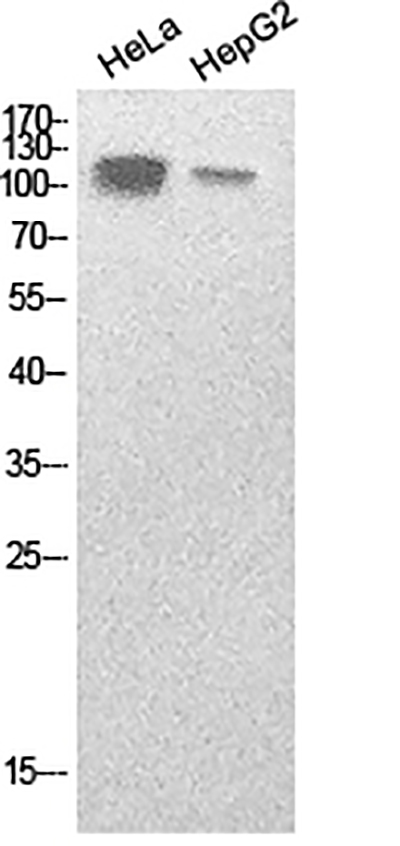 SREBP1 Rabbit Polyclonal Antibody | 兔多抗 | EnkiLife恩玑生命