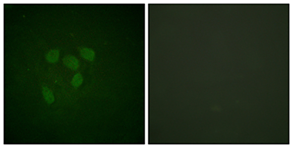 Acetyl p53 (K319) Rabbit Polyclonal Antibody | 兔多抗 | EnkiLife恩玑生命