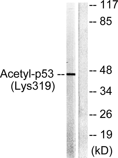 Acetyl p53 (K319) Rabbit Polyclonal Antibody | 兔多抗 | EnkiLife恩玑生命
