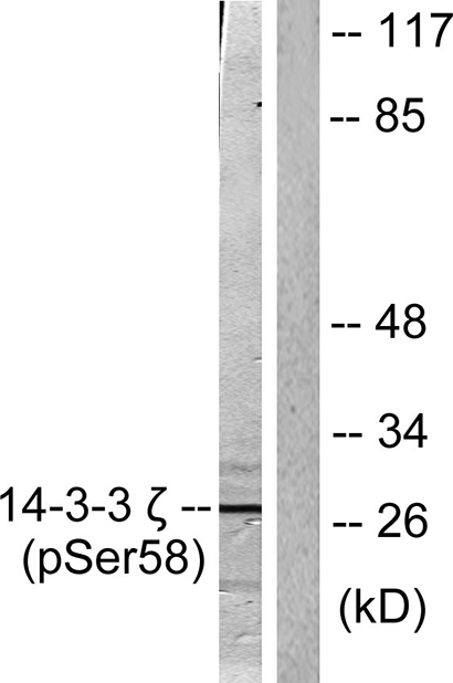 14-3-3 ζ (phospho Ser58) Rabbit Polyclonal Antibody | 兔多抗 | EnkiLife恩玑生命