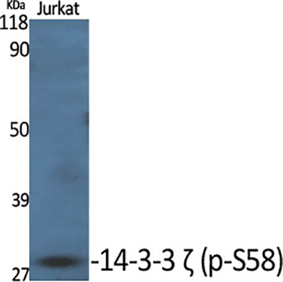 14-3-3 ζ (phospho Ser58) Rabbit Polyclonal Antibody | 兔多抗 | EnkiLife恩玑生命