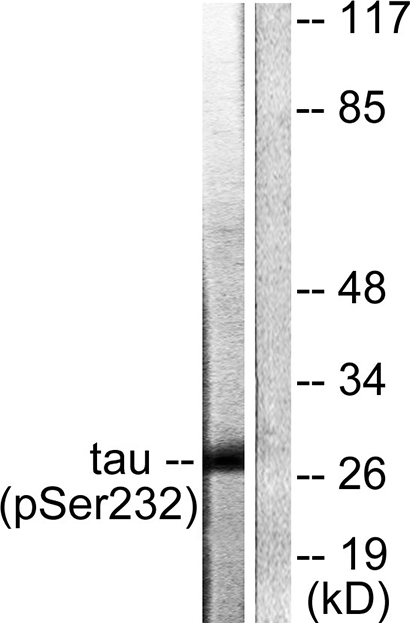 14-3-3 θ/τ (phospho Ser232) Rabbit Polyclonal Antibody | 兔多抗 | EnkiLife恩玑生命