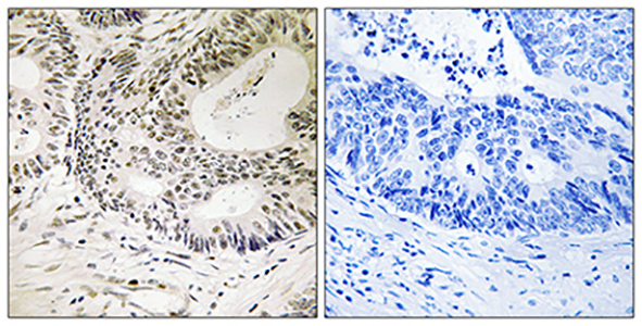 53BP1 (phospho Ser25) Rabbit Polyclonal Antibody | 兔多抗 | EnkiLife恩玑生命