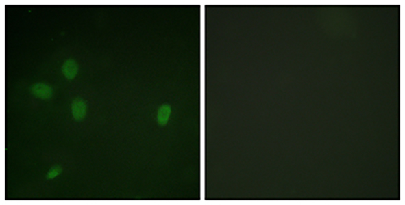 53BP1 (phospho Ser25) Rabbit Polyclonal Antibody | 兔多抗 | EnkiLife恩玑生命